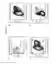 Fig. 35 - Methods of producing pancreatic hormones