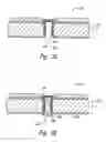 Fig. 05 - Packaged microelectronic imagers and methods of packaging microelectronic imagers