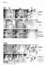 Fig. 02 - METHOD OF DIAGNOSING BREAST CANCER