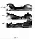 Fig. 06 - METHOD FOR STIMULATING WOUND HEALING