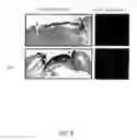 Fig. 09 - METHOD FOR STIMULATING WOUND HEALING