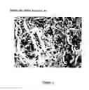 Fig. 02 - Composite containing collagen and elastin as a dermal expander and tissue filler