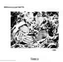 Fig. 07 - Composite containing collagen and elastin as a dermal expander and tissue filler