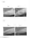 Fig. 02 - Potentiator of radiation therapy