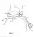 Fig. 02 - ASSEMBLY AND METHOD FOR AUTOMATICALLY CONTROLLING PRESSURE FOR A GASTRIC BAND