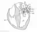 Fig. 01 - METHODS AND DEVICES FOR TISSUE GRASPING AND ASSESSMENT