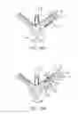 Fig. 32 - METHODS AND DEVICES FOR TISSUE GRASPING AND ASSESSMENT