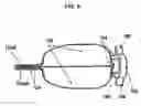 Fig. 07 - Septal splint