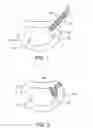 Fig. 02 - Soft tissue repair system