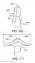 Fig. 49 - Soft tissue repair system