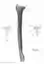 Fig. 02 - FRACTURE-SPECIFIC DISTAL RADIUS PLATES
