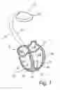 Fig. 02 - IMPLANTED HEART-STIMULATION DEVICE ENABLING CHARGE BALANCE AFTER STIMULATION SEQUENCE