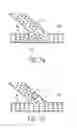 Fig. 02 - METHOD AND APPARATUS FOR STENTING