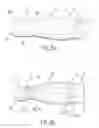 Fig. 06 - METHOD AND APPARATUS FOR STENTING