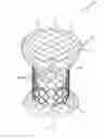 Fig. 01 - HEART VALVE PROSTHESIS USING DIFFERENT TYPES OF LIVING TISSUE AND METHOD OF FABRICATING THE SAME
