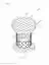 Fig. 04 - HEART VALVE PROSTHESIS USING DIFFERENT TYPES OF LIVING TISSUE AND METHOD OF FABRICATING THE SAME