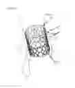 Fig. 09 - HEART VALVE PROSTHESIS USING DIFFERENT TYPES OF LIVING TISSUE AND METHOD OF FABRICATING THE SAME