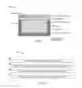Fig. 02 - Implantable pressure-actuated drug delivery systems and methods of manufacture and use