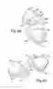 Fig. 05 - Readily burstable slide fastener