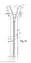 Fig. 13 - Readily burstable slide fastener