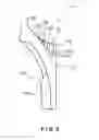 Fig. 10 - Transmission shift fork