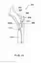 Fig. 12 - Transmission shift fork