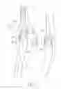 Fig. 03 - PLIERS WITH RESTORING FUNCTION
