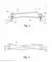 Fig. 03 - Shoulder rest