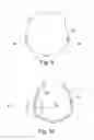Fig. 06 - Shoulder rest