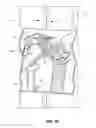 Fig. 09 - Emergency escape ladder