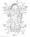 Fig. 12 - Wearable device