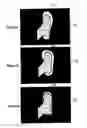 Fig. 03 - Method for selecting a shoe fitted to a foot and assemblies therefor