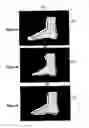 Fig. 04 - Method for selecting a shoe fitted to a foot and assemblies therefor