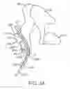 Fig. 08 - Balanced armature devices and methods for hearing