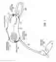 Fig. 02 - Hearing Instrument