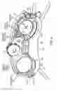Fig. 06 - Hearing Instrument