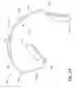 Fig. 03 - Soft-opening hinge and headphone set including same