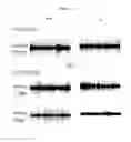 Fig. 02 - METHOD FOR THE PREVENTION AND TREATMENT OF ESSENTIAL TREMOR BY REGULATING alpha1G T-TYPE CALCIUM CHANNEL OR BY T-TYPE CALCIUM CHANNEL BLOCKERS