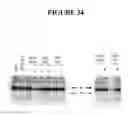 Fig. 35 - Methods for targeted cleavage and recombination of CCR5
