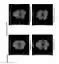 Fig. 35 - Antibodies That Specifically Bind to DR3