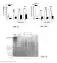 Fig. 02 - Methods of treating thyroid eye disease