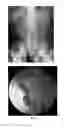 Fig. 02 - Enterically coated cysteamine, cystamine and derivatives thereof