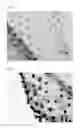 Fig. 02 - SPHEROID COMPOSITE, SPHEROID-CONTAINING HYDROGEL AND PROCESSES FOR PRODUCTION OF SAME