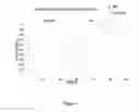 Fig. 03 - BIOMARKERS FOR DIAGNOSIS OF TRANSIENT ISCHEMIC ATTACKS