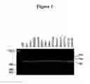 Fig. 02 - POT1 alternative splicing variants