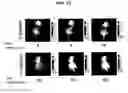Fig. 11 - Compositions for the treatment of cancer, and methods for testing and using the same