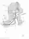 Fig. 02 - Fully or Partially Implantable Hearing System