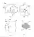 Fig. 02 - Surgical system with clips for identifying the orientation of a tissue sample