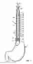 Fig. 02 - Display system for displaying conditions of esophageal mucosa and indications of gastroesophageal reflux disease