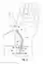 Fig. 03 - Nerve Path Adaptable Nerve Testing Device